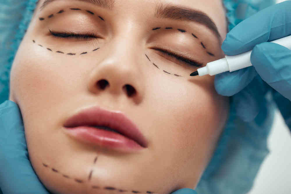 Downsides of Traditional Facelift Procedures