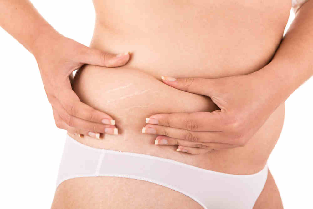 What is Fat Grafting?